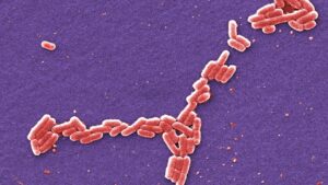 University of Arkansas E. coli Outbreak Hospitalizes 4 Students