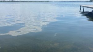 Fatal Amoeba Infection Claims Texas Resident Who Swam in Lake