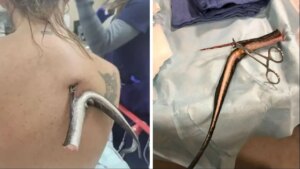 Florida Beach Horror: Woman Impaled by Stingray 😱