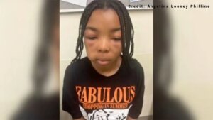 13-year-old girl gets attacked at Southern California McDonald’s, while bystanders pull out phones and record