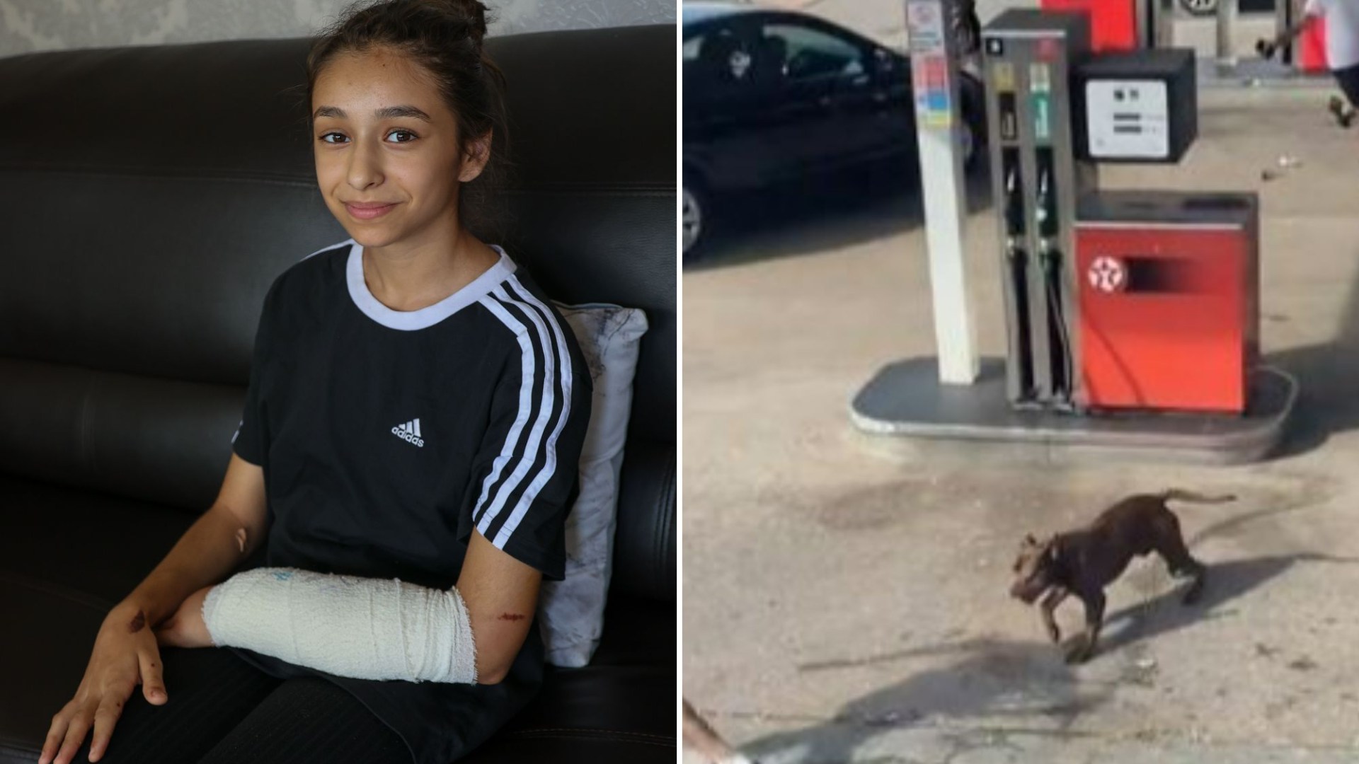 I thought I’d die when I was mauled by savage XL Bully, 11-year-old girl reveals as new vid shows attack that injured 3